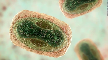 Caso confirmado de viruela del mono en Santa Cruz: un paciente joven-adulto recibe tratamiento en un centro de salud estatal.