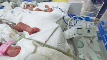 La sobrecarga en maternidades: Percy Boland enfrenta críticos niveles de ocupación con 70.000 nacimientos al año en Santa Cruz.